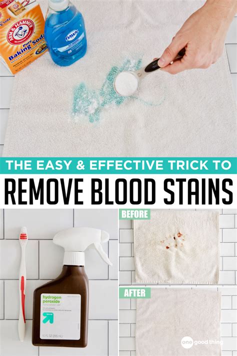 products to remove blood stains